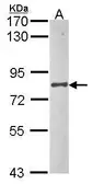 Anti-UBA2 antibody [N1N3] used in Western Blot (WB). GTX102613