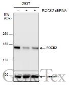 Anti-ROCK2 antibody used in Western Blot (WB). GTX102619