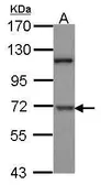 Anti-DYRK1B antibody used in Western Blot (WB). GTX102623