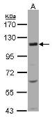 Anti-KCC4 antibody [C2C3], C-term used in Western Blot (WB). GTX102628