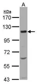 Anti-KCC4 antibody [C2C3], C-term used in Western Blot (WB). GTX102628