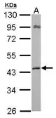 Anti-ACAT1 antibody [N1N3] used in Western Blot (WB). GTX102637