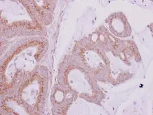Anti-GBF1 antibody [N1], N-term used in IHC (Paraffin sections) (IHC-P). GTX102644