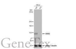 Anti-DDR2 antibody [C2C3], C-term used in Western Blot (WB). GTX102651