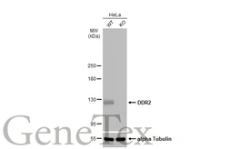 Anti-DDR2 antibody [C2C3], C-term used in Western Blot (WB). GTX102651