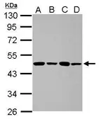 Anti-PPME1 antibody used in Western Blot (WB). GTX102660