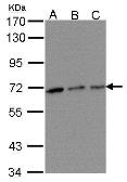 Anti-TROVE2 antibody [N2C3] used in Western Blot (WB). GTX102663