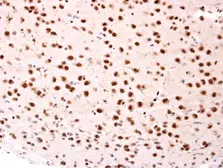 Anti-beta-TrCP antibody [N1C1] used in IHC (Paraffin sections) (IHC-P). GTX102667
