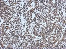 Anti-MDC1 antibody [N2N3] used in IHC (Paraffin sections) (IHC-P). GTX102673