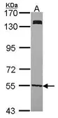Anti-UGP2 antibody [N1C1] used in Western Blot (WB). GTX102684