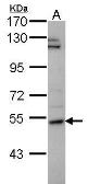 Anti-P4HA2 antibody [N1C3] used in Western Blot (WB). GTX102695