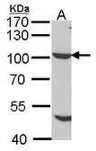 Anti-NUP98 antibody [N1N2], N-term used in Western Blot (WB). GTX102699