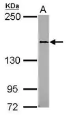 Anti-CD100 antibody [N2C2], Internal used in Western Blot (WB). GTX102705