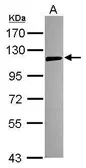 Anti-TLR5 antibody [N2C2], Internal used in Western Blot (WB). GTX102706