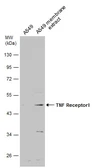 Anti-TNF Receptor I antibody used in Western Blot (WB). GTX102710