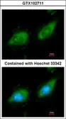 Anti-MAP3K8 antibody [N3C3] used in Immunocytochemistry/ Immunofluorescence (ICC/IF). GTX102711