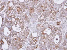 Anti-MAP3K8 antibody [N3C3] used in IHC (Paraffin sections) (IHC-P). GTX102711