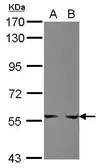 Anti-PPAT antibody used in Western Blot (WB). GTX102725
