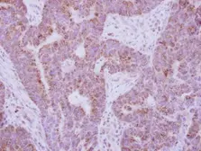 Anti-IL10 Receptor alpha antibody used in IHC (Paraffin sections) (IHC-P). GTX102731
