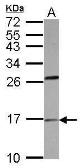 Anti-PLA2G1B antibody [N1C3] used in Western Blot (WB). GTX102749
