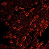 Anti-Mu Opioid receptor antibody used in Immunohistochemistry (IHC). GTX10275