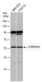 Anti-CYP17A1 antibody [N1C2] used in Western Blot (WB). GTX102753