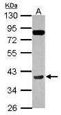 Anti-Cyclin H antibody [N1C3] used in Western Blot (WB). GTX102754