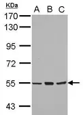 Anti-CYP4B1 antibody used in Western Blot (WB). GTX102757