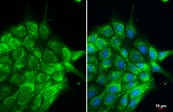 Anti-Cytokeratin 2 antibody [N2C2], Internal used in Immunocytochemistry/ Immunofluorescence (ICC/IF). GTX102758