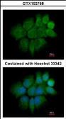 Anti-Cytokeratin 2 antibody [N2C2], Internal used in Immunocytochemistry/ Immunofluorescence (ICC/IF). GTX102758