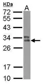 Anti-HLA-DPB1 antibody used in Western Blot (WB). GTX102763