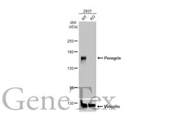 Anti-Peregrin antibody [N1N2], N-term used in Western Blot (WB). GTX102778