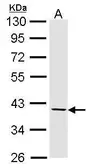 Anti-Fibromodulin antibody used in Western Blot (WB). GTX102783