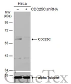 Anti-CDC25C antibody used in Western Blot (WB). GTX102809