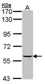 Anti-IMPDH1 antibody [N1C1] used in Western Blot (WB). GTX102814