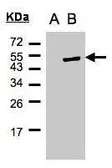 Anti-Cytohesin 1 antibody [N1C1] used in Western Blot (WB). GTX102825