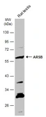 Anti-ARSB antibody [N3C3] used in Western Blot (WB). GTX102829