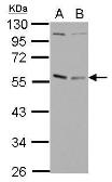 Anti-GABPA antibody used in Western Blot (WB). GTX102830