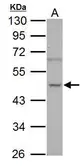Anti-NOVA1 antibody used in Western Blot (WB). GTX102831