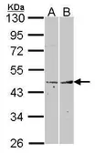 Anti-Fibromodulin antibody [N3C3] used in Western Blot (WB). GTX102832