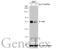 Anti-AF9 antibody used in Western Blot (WB). GTX102835
