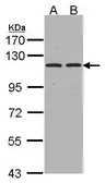 Anti-Aminopeptidase A antibody [C2C3], C-term used in Western Blot (WB). GTX102838