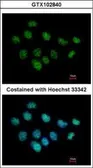 Anti-XPC antibody [C2C3], C-term used in Immunocytochemistry/ Immunofluorescence (ICC/IF). GTX102840