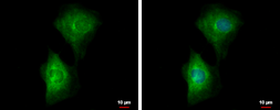 Anti-PDE4B antibody used in Immunocytochemistry/ Immunofluorescence (ICC/IF). GTX102842