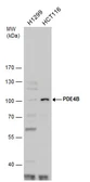 Anti-PDE4B antibody used in Western Blot (WB). GTX102845
