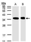 Anti-N-myc interactor antibody [N1C3] used in Western Blot (WB). GTX102866