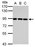 Anti-Plasminogen antibody used in Western Blot (WB). GTX102877
