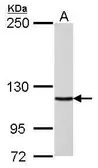 Anti-DNA polymerase delta antibody used in Western Blot (WB). GTX102888