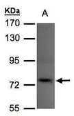 Anti-TLK1 antibody [N2C2], Internal used in Western Blot (WB). GTX102891