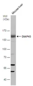 Anti-DIAPH3 antibody [C1C3] used in Western Blot (WB). GTX102892